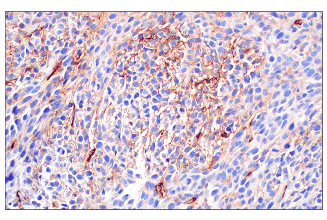 Immunohistochemistry Image 6: PNPLA3 (E7N6O) Rabbit mAb (BSA and Azide Free)