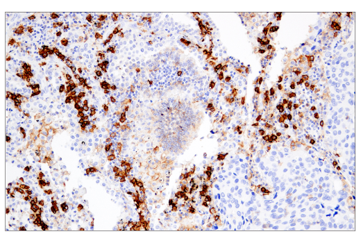 Immunohistochemistry Image 5: CD38 (E7Z8C) XP<sup>®</sup> Rabbit mAb (BSA and Azide Free)