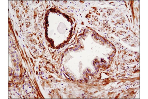 Immunohistochemistry Image 2: Phospho-EphA2 (Ser897) (D9A1) Rabbit mAb