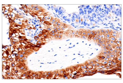 Immunohistochemistry Image 1: CD109 (E4I2V) Rabbit mAb