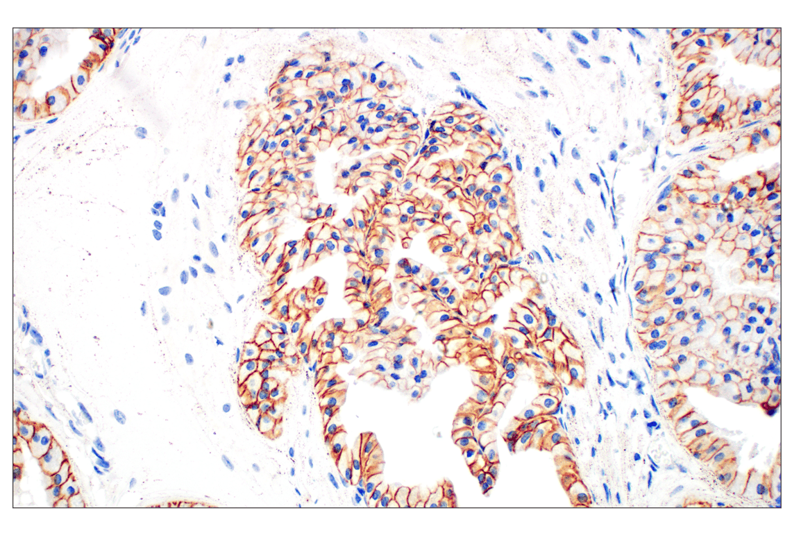 undefined Image 32: Cadherin-Catenin Antibody Sampler Kit