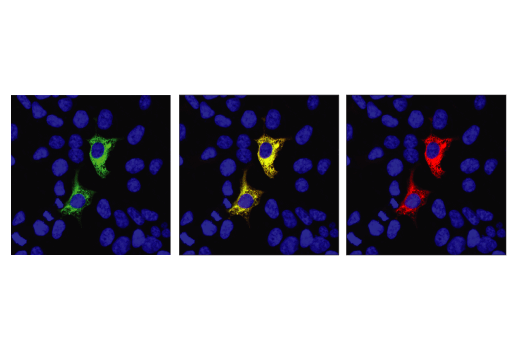 undefined Image 14: Cas9 and Associated Proteins Antibody Sampler Kit