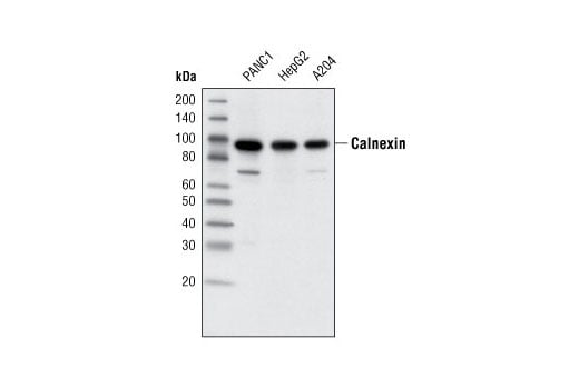 undefined Image 13: MHC Class I Antigen Processing and Presentation Antibody Sampler Kit