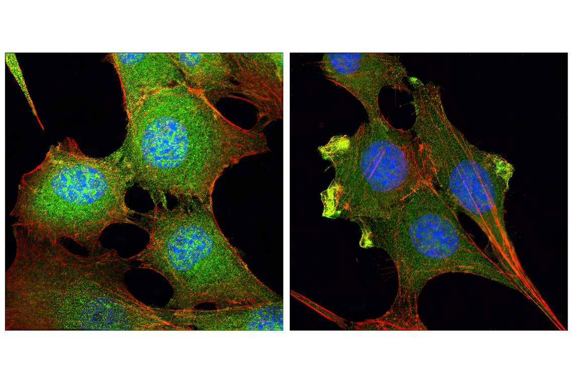 Immunofluorescence Image 1: Akt (pan) (C67E7) Rabbit mAb