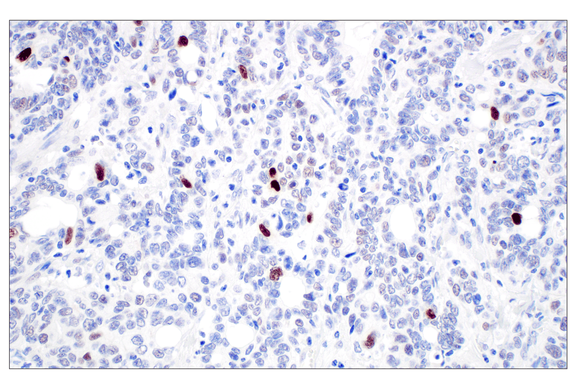 Immunohistochemistry Image 4: MDM2 (F7W7X) Rabbit mAb