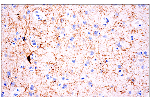 Immunohistochemistry Image 1: Calretinin (E7R6O) XP<sup>®</sup> Rabbit mAb