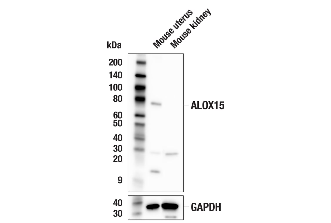 Western Blotting Image 3: ALOX15 (E5D1C) Rabbit mAb