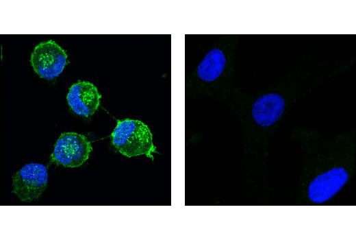 Immunofluorescence Image 1: PDGF Receptor α (D1E1E) XP<sup>®</sup> Rabbit mAb (BSA and Azide Free)