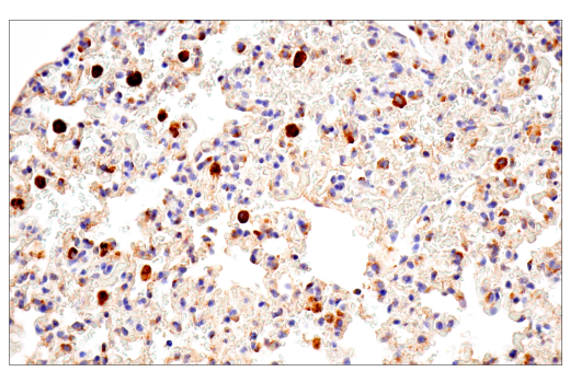 Immunohistochemistry Image 3: Cathepsin D (E7Z4L) XP<sup>®</sup> Rabbit mAb