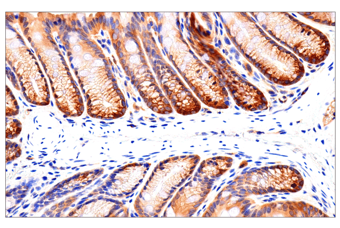 Immunohistochemistry Image 5: Caspase-8 (F5K9P) Rabbit mAb (BSA and Azide Free)