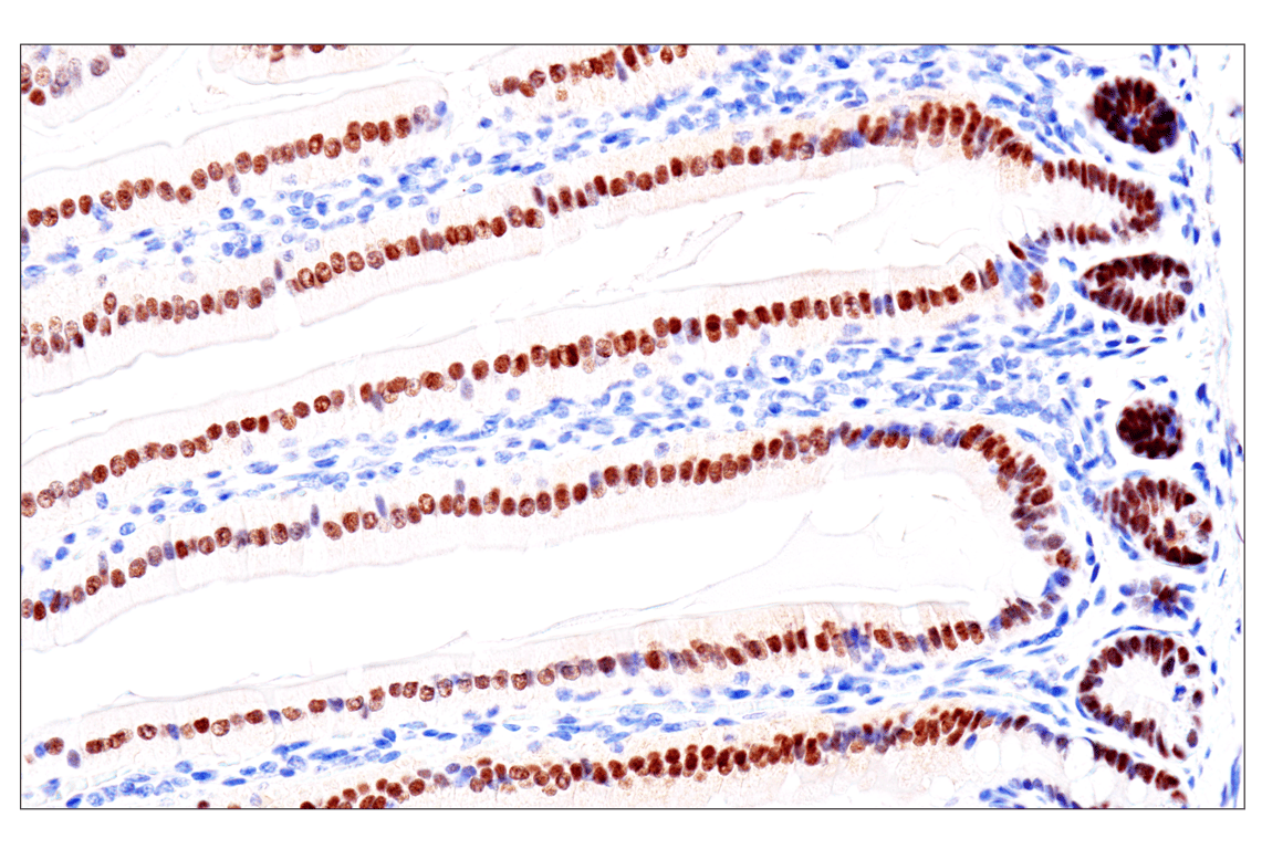 Immunohistochemistry Image 21: GATA-6 (D61E4) XP<sup>®</sup> Rabbit mAb (BSA and Azide Free)