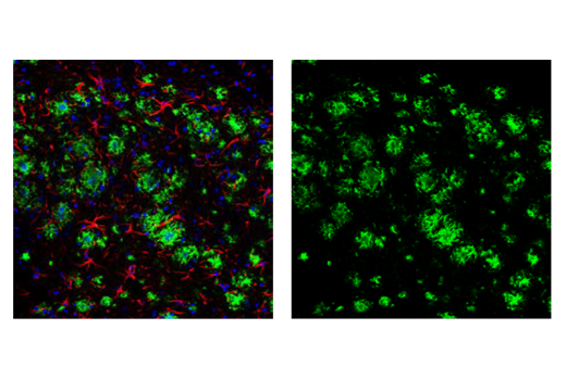 Immunofluorescence Image 1: β-Amyloid (D54D2) XP<sup>®</sup> Rabbit mAb