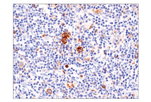 Immunohistochemistry Image 1: TNFRSF8/CD30 (E4L4I) XP<sup>®</sup> Rabbit mAb