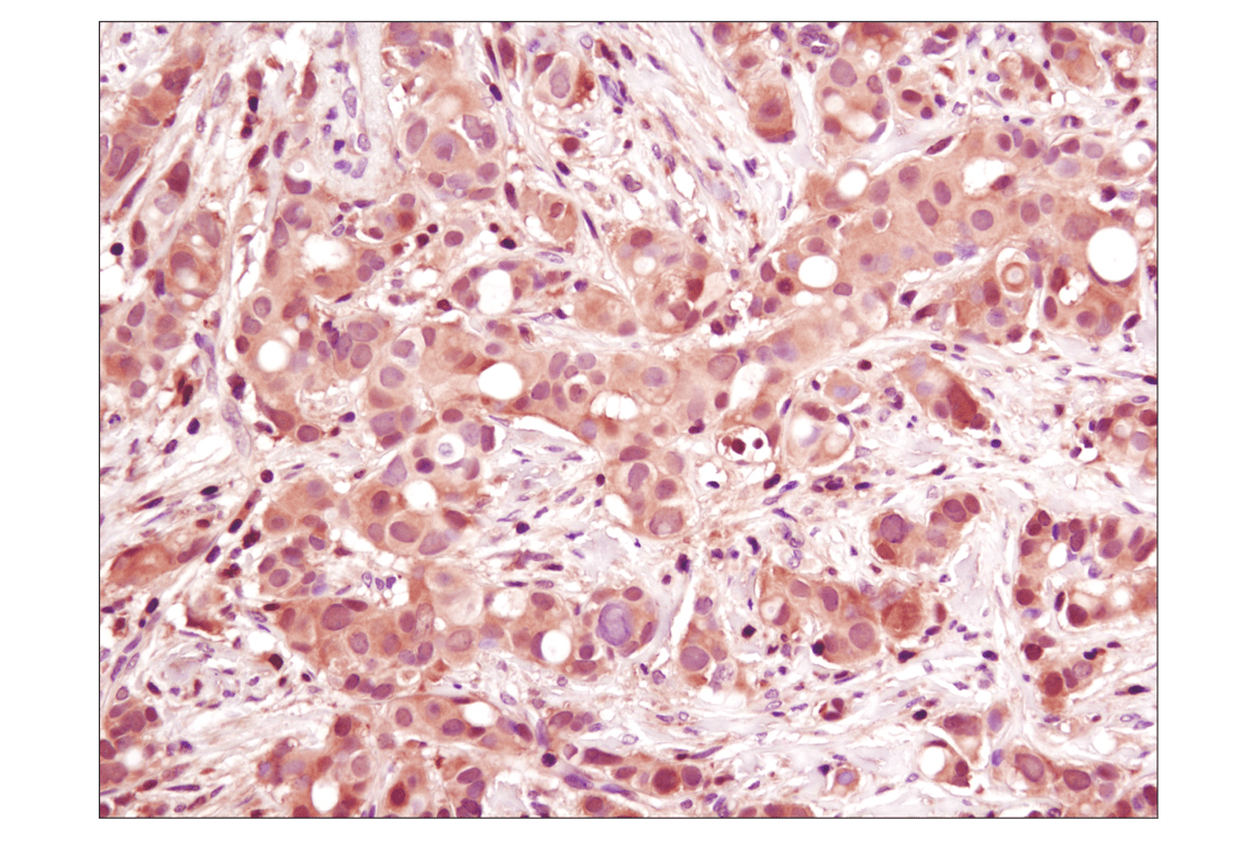 undefined Image 4: PhosphoPlus<sup>®</sup> p38 MAPK (Thr180/Tyr182) Antibody Duet