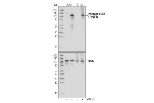 Western Blotting Image 1: Phospho-Stat2 (Tyr690) (D3P2P) Rabbit mAb (BSA and Azide Free)