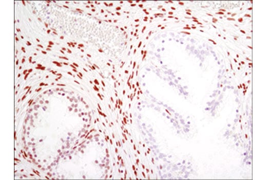 Immunohistochemistry Image 3: MeCP2 (D4F3) XP<sup>®</sup> Rabbit mAb