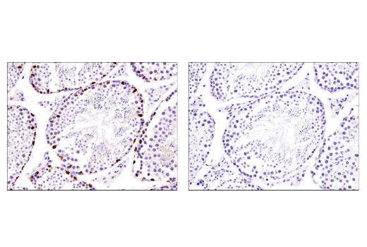 Immunohistochemistry Image 5: Sox9 (D8G8H) Rabbit mAb (BSA and Azide Free)