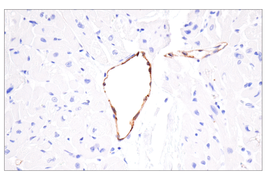 Immunohistochemistry Image 6: CD62P/P-Selectin (E8Q1W) XP<sup>®</sup> Rabbit mAb (BSA and Azide Free)
