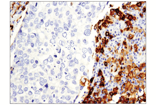 Immunohistochemistry Image 2: CD163 (D6U1J) Rabbit mAb