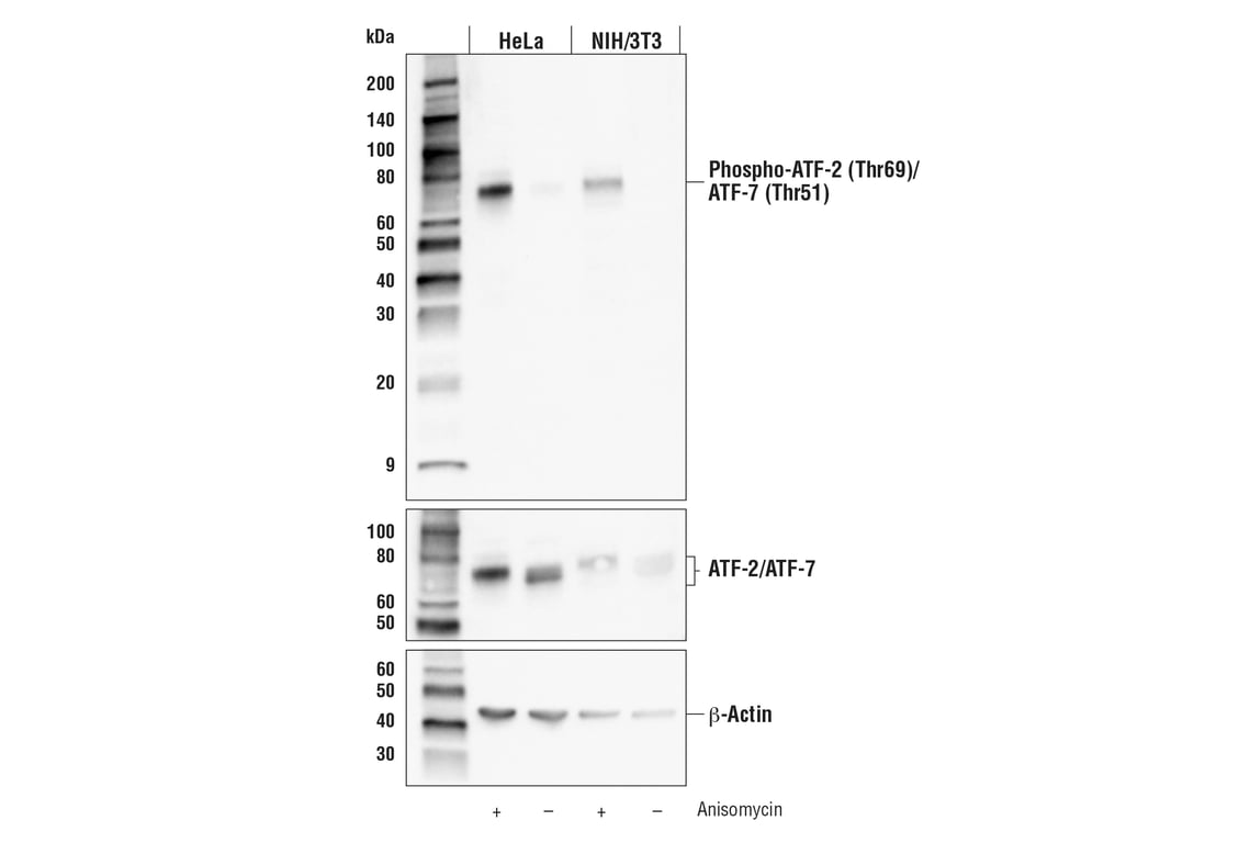 Western Blotting Image 1: Phospho-ATF-2 (Thr69)/ATF-7 (Thr51) (E3D6B) Rabbit mAb