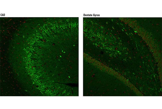 Immunofluorescence Image 1: Huntingtin (D7F7) XP<sup>®</sup> Rabbit mAb