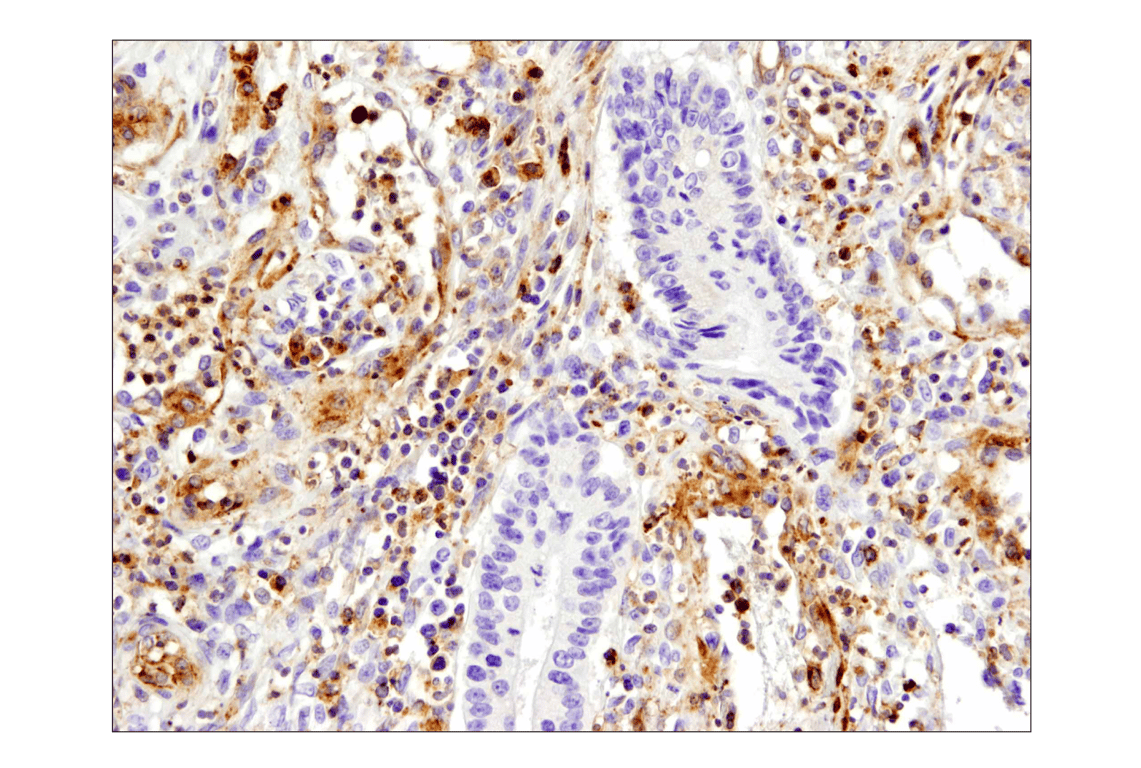 Immunohistochemistry Image 4: VISTA (D1L2G<sup>™</sup>) XP<sup>®</sup> Rabbit mAb