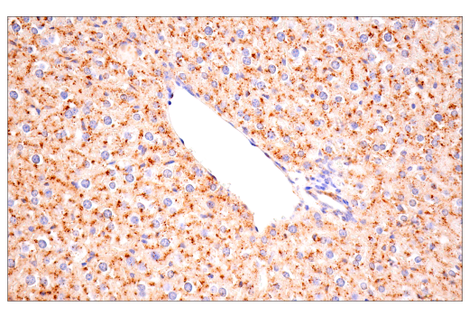 Immunohistochemistry Image 1: Cathepsin D (E7Z4L) XP<sup>®</sup> Rabbit mAb