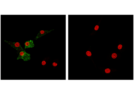 undefined Image 60: Mouse Reactive M1 vs M2 Macrophage IHC Antibody Sampler Kit