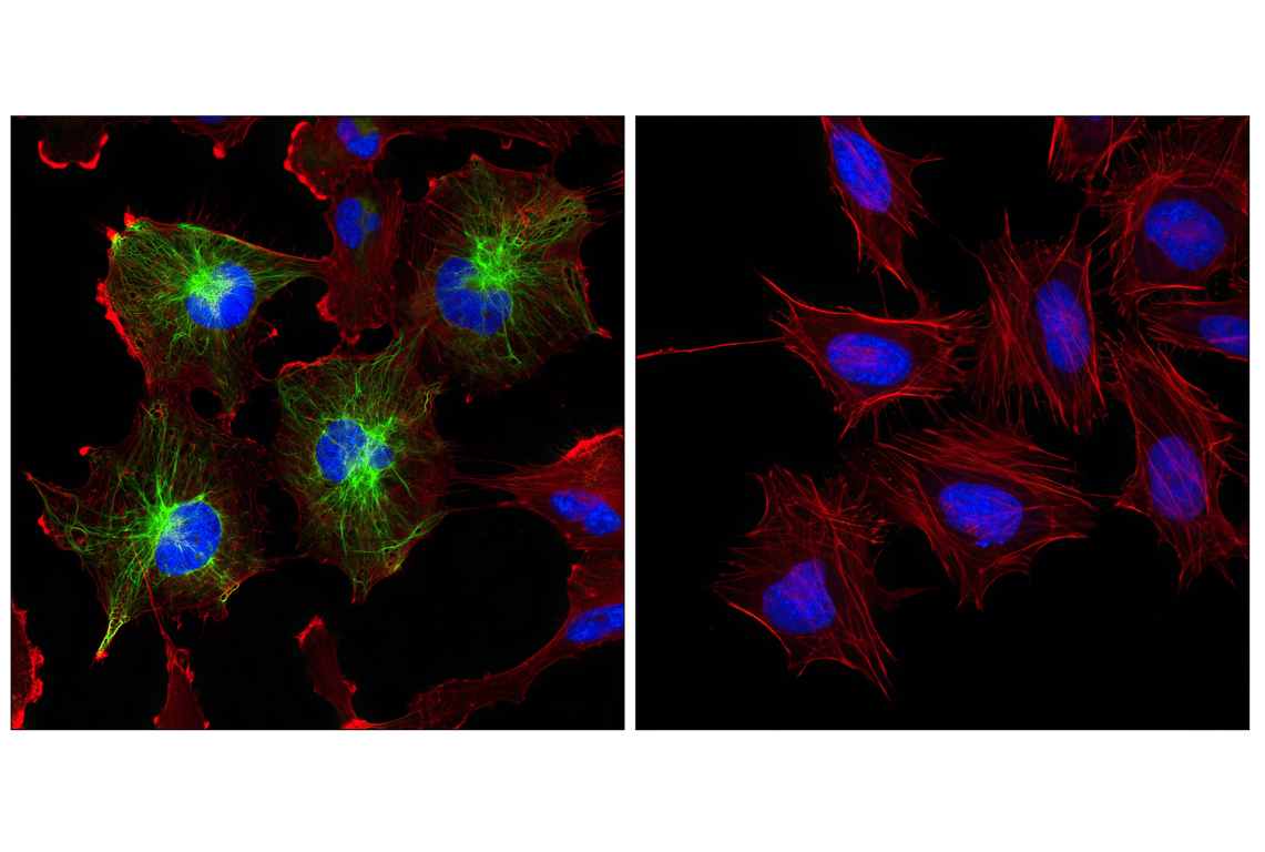 Immunofluorescence Image 1: GFAP (GA5) Mouse mAb (BSA and Azide Free)