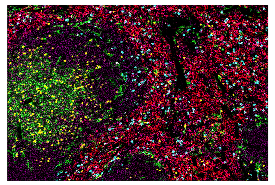 Immunohistochemistry Image 1: FoxP3 (D6O8R) & CO-0041-488 SignalStar<sup>™</sup> Oligo-Antibody Pair