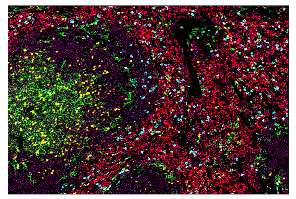 Immunohistochemistry Image 1: FoxP3 (D6O8R) & CO-0041-647 SignalStar™ Oligo-Antibody Pair