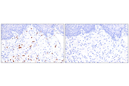 Immunohistochemistry Image 8: LRRK2 (E8Z7T) Mouse mAb