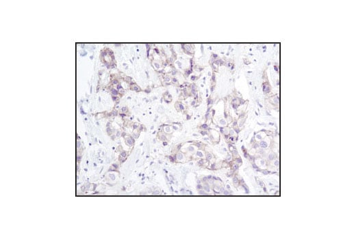 Immunohistochemistry Image 1: γ-Catenin Antibody