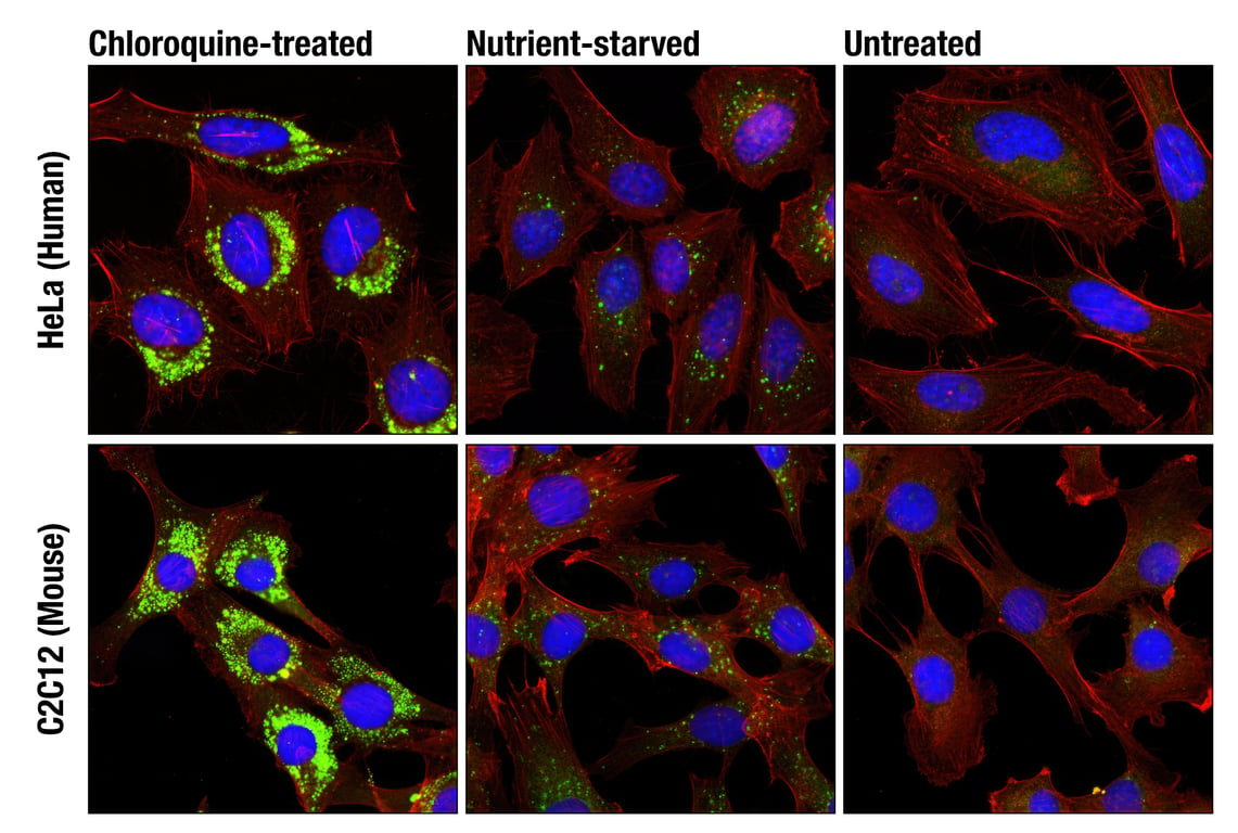 Immunofluorescence Image 1: LC3A/B (D3U4C) XP<sup>®</sup> Rabbit mAb (BSA and Azide Free)