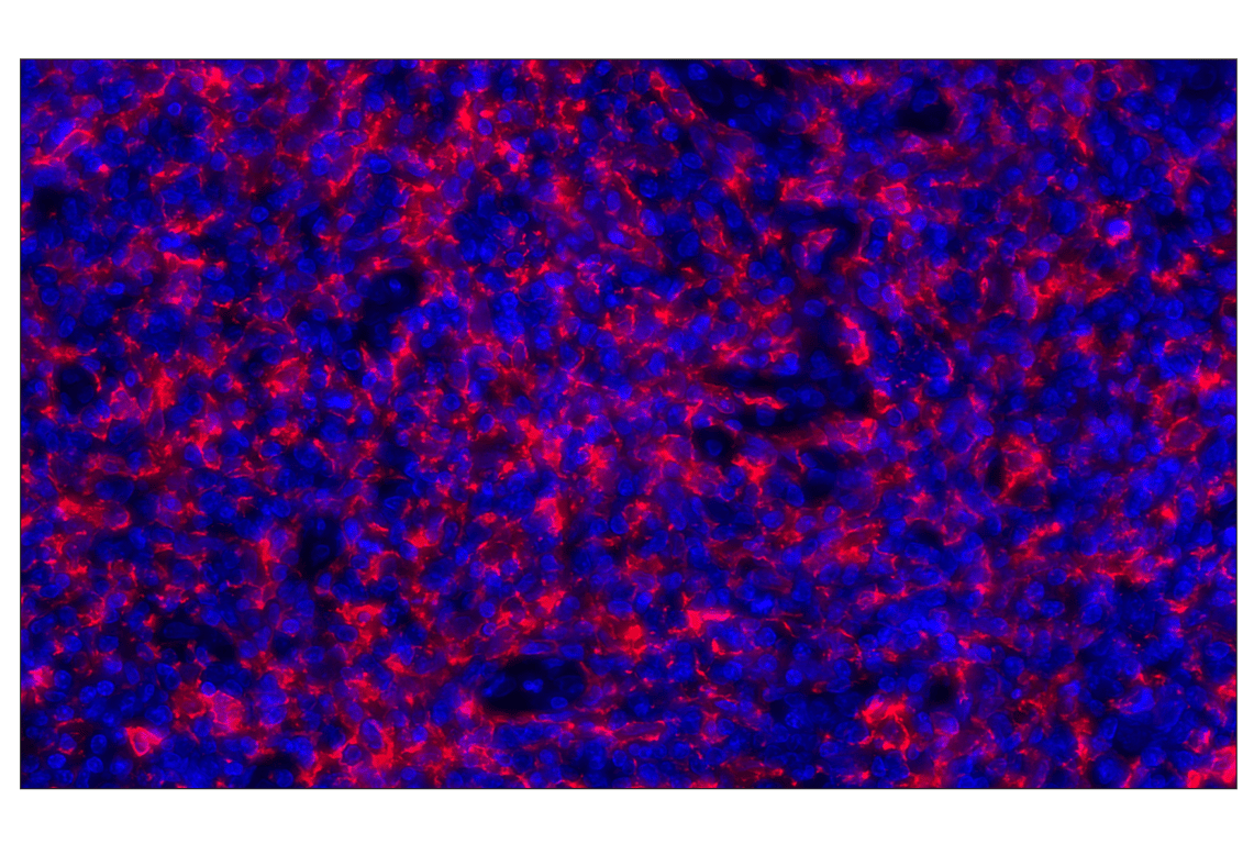 Immunohistochemistry Image 2: Iba1/AIF-1 (E4O4W) XP<sup>®</sup>  Rabbit mAb (Alexa Fluor<sup>®</sup> 647 Conjugate)