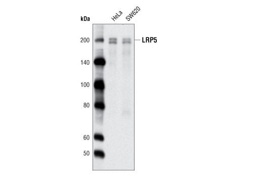 Western Blotting Image 1: LRP5 (D5G4) Rabbit mAb