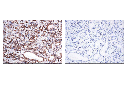 undefined Image 14: Branched-Chain Amino Acid Metabolism Antibody Sampler Kit