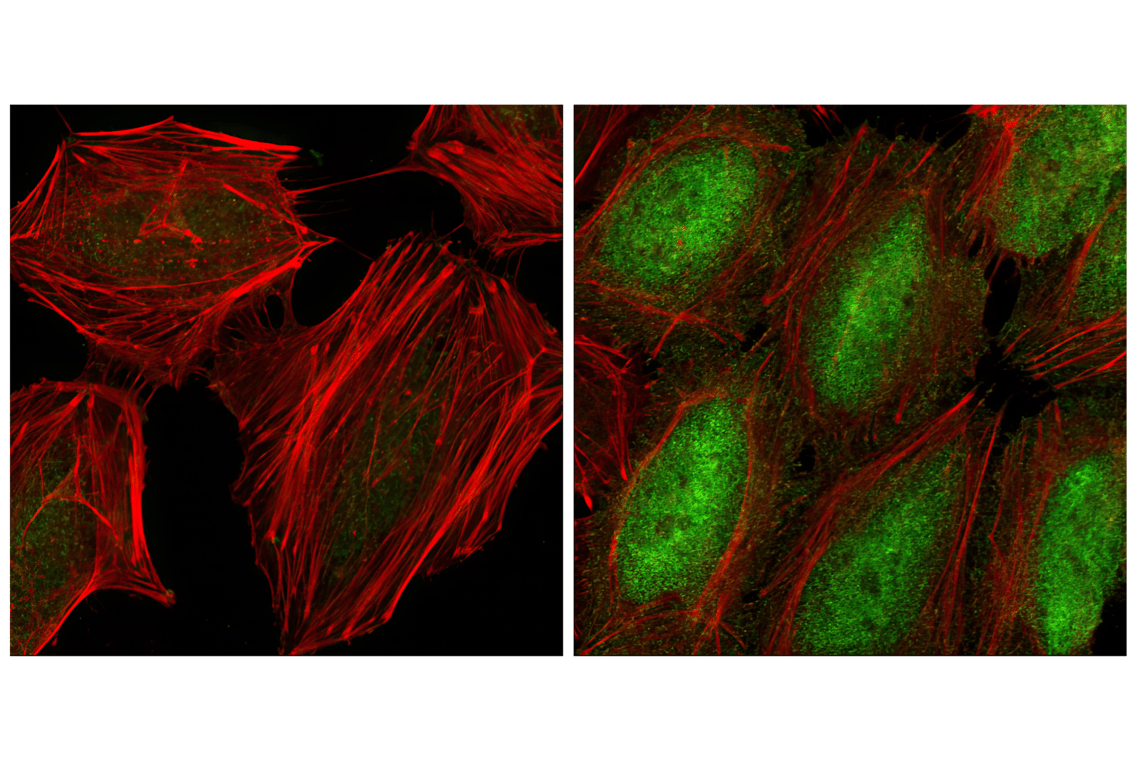 undefined Image 6: PhosphoPlus<sup>®</sup> NF-κB p65/RelA (Ser536) Antibody Duet