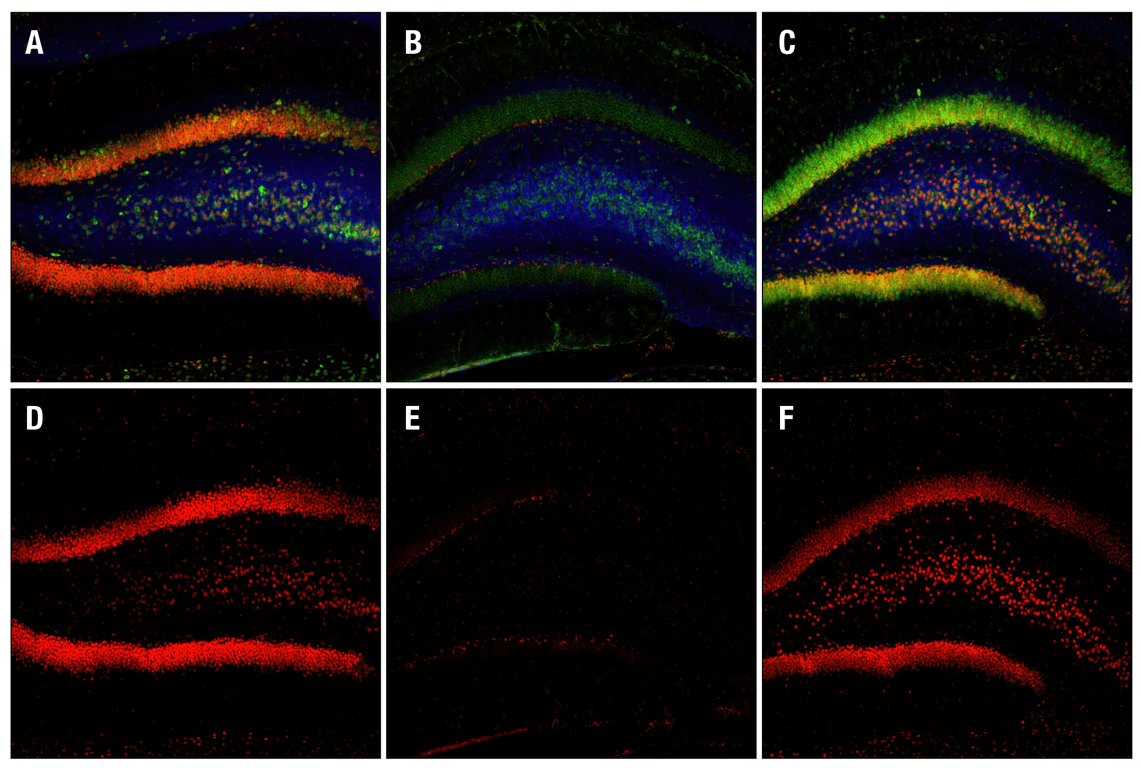 undefined Image 15: PhosphoPlus<sup>®</sup> CREB (Ser133) Antibody Duet