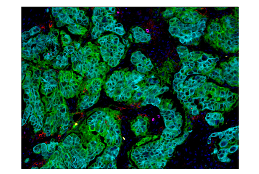 Immunohistochemistry Image 3: B7-H4 (D1M8I) XP<sup>®</sup> Rabbit mAb (BSA and Azide Free)