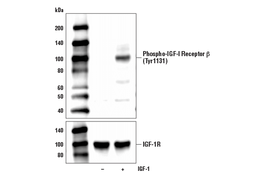 Western Blotting Image 1: Phospho-IGF-I Receptor β (Tyr1131)/Insulin Receptor β (Tyr1146) (D6D5L) Rabbit mAb (BSA and Azide Free)
