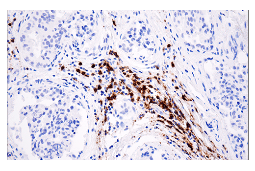 Immunohistochemistry Image 2: CD20 (E7B7T) XP<sup>®</sup> Rabbit mAb