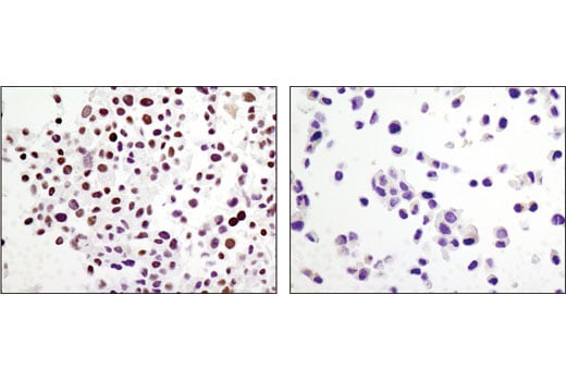 undefined Image 33: BAF Complex IHC Antibody Sampler Kit