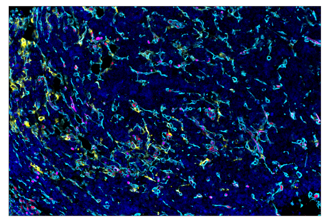 Immunohistochemistry Image 2: Vimentin (D21H3) & CO-0012-647 SignalStar<sup>™</sup> Oligo-Antibody Pair