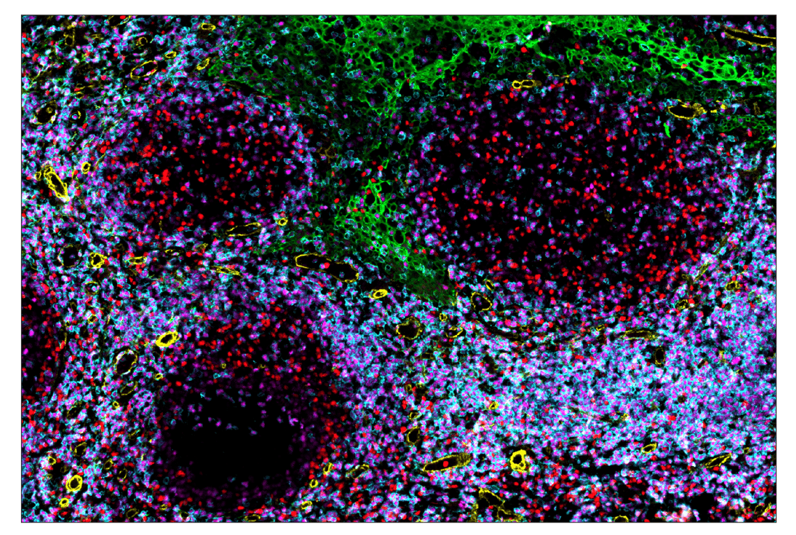 Immunohistochemistry Image 5: T-bet/TBX21 (E4I2K) & CO-0077-647 SignalStar<sup>™</sup> Oligo-Antibody Pair