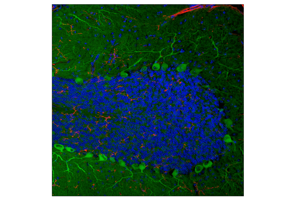 Immunofluorescence Image 1: PIP4K2C (E7P3S) Rabbit mAb (Alexa Fluor® 488 Conjugate)