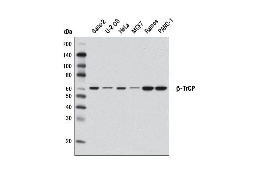 Western Blotting Image 1: β-TrCP (D12C8) Rabbit mAb