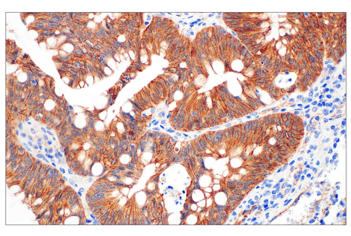 Immunohistochemistry Image 2: β-Catenin (D10A8) XP<sup>®</sup> Rabbit mAb (BSA and Azide Free)
