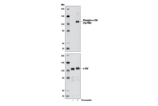 Western Blotting Image 1: Phospho-c-Cbl (Tyr700) (D16D7) Rabbit mAb