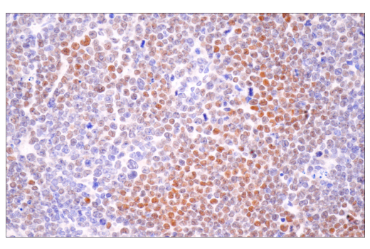 Immunohistochemistry Image 5: HIF-1α (E1V6A) Rabbit mAb
